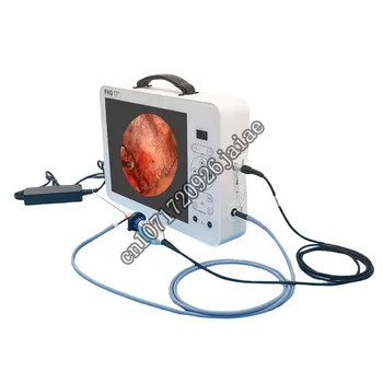 Медицинский эндоскоп, портативная эндоскопическая лапароскопическая система, система arthroscopi